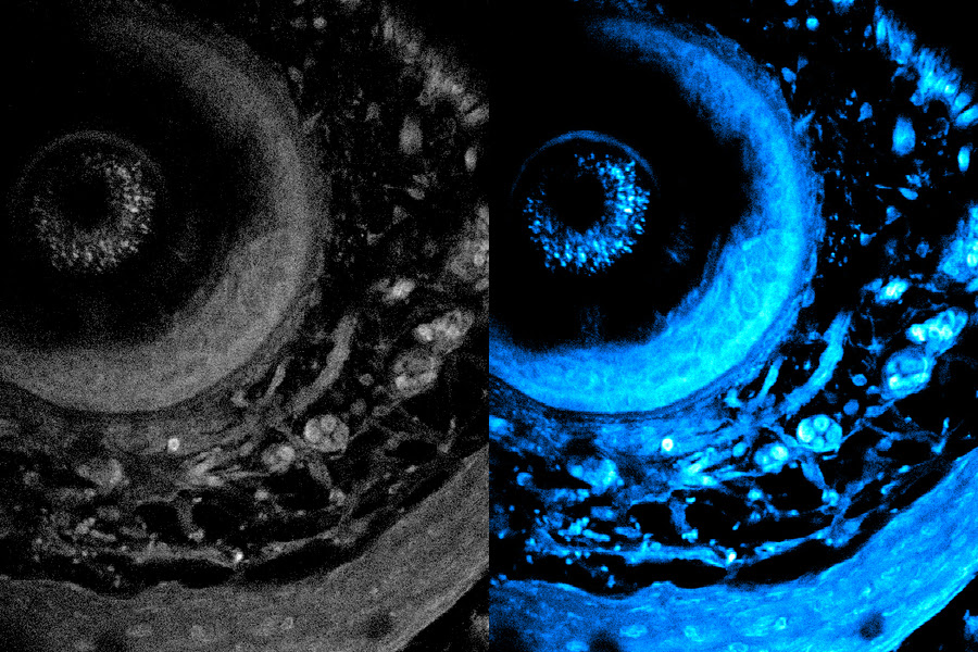 Two images; on left the image is monochrome and blurrier. On right, the image is in blue and shows more of the cellular objects.