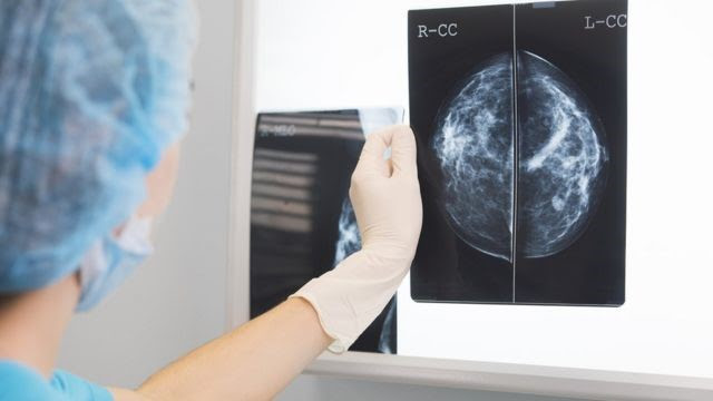 MedPlus conscientiza mulheres para 05. 02 Dia Nacional da mamografia