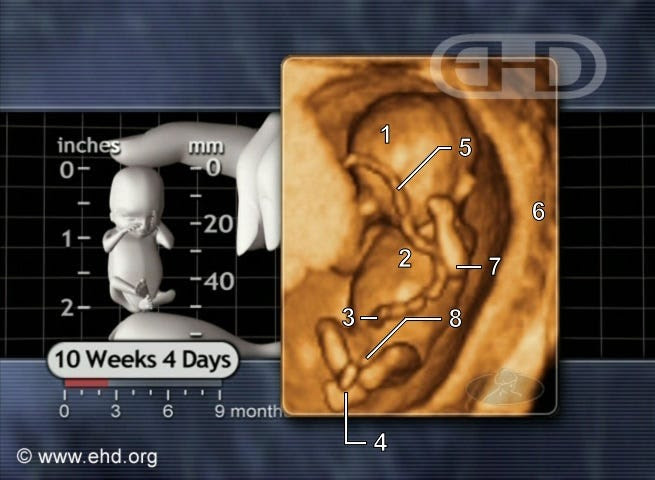 ultrasound of baby at 10 wks 4 days