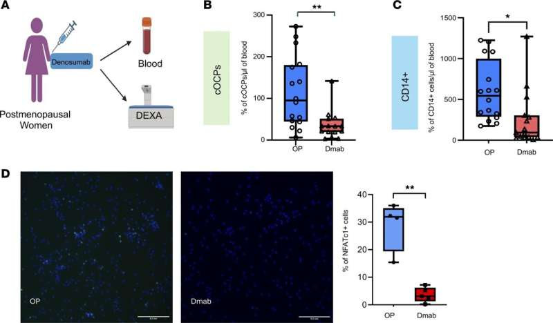 HSS researchers identify potential biomarkers and targets for osteoporosis