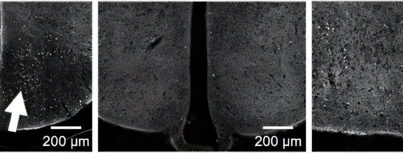 SNU researchers develops micro-shockwave electronic therapy for safe non-invasive treatment of brain disorders