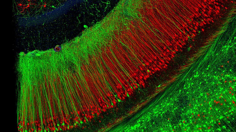 Fluorescent light micrograph of neuronal (nerve cell) fibres in bright red and green.