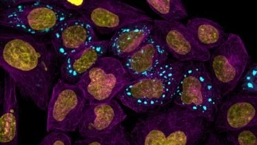 Microtubules Highlighting the Cell Body With Nucleus and Condensates