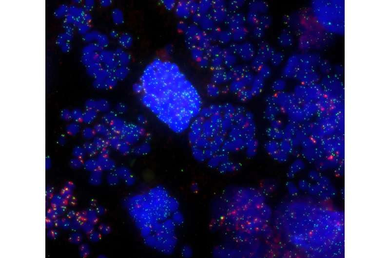 Unexpected discovery about how cells avoid cancer