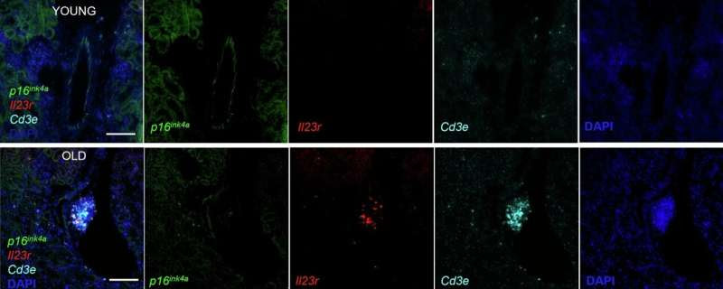 Researchers catch aging cells in the act with novel senescent cell biomarker