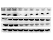 Easy to Use Immobilon Forte Western HRP Substrate From Millipore Sigma for Western Blot