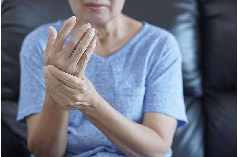 Early rheumatoid arthritis tied to hypertension