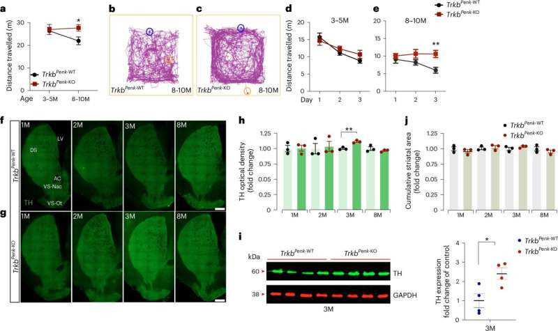 Discovery of key mechanism in Huntington's disease could pave the way for early detection and treatment