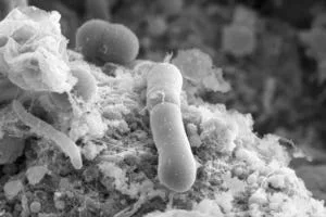 Scanning Electron Microscopy image of C. difficile in the gut of an infected animal - The University of Sheffield