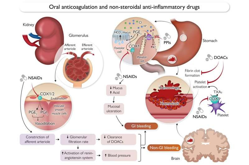 Risk of internal bleeding doubles when people on anticoagulants take NSAID painkiller, study reveals