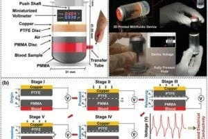 Vision of the proposed research for developing a self-powered, millifluidic lab-on-a-chip device to determine blood conductivity. a) Schematics and dimensions of the proposed device. The blood layer, copper electrodes, PTFE disc, and PMMA elements form a contact-separation mode TENG system. The blood sample is sandwiched between two PMMA layers and serves as one of the conductive layers. Any change in its electrical conductivity would theoretically change the voltage signal generated by the device. b) Operating principle of this blood-based TENG device. c) The 3D printed device and the type of voltage signal generated by it.