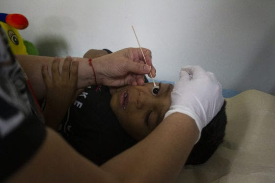 Desconocimiento sobre glaucoma infantil aumenta vulnerabilidad de pacientes en Venezuela