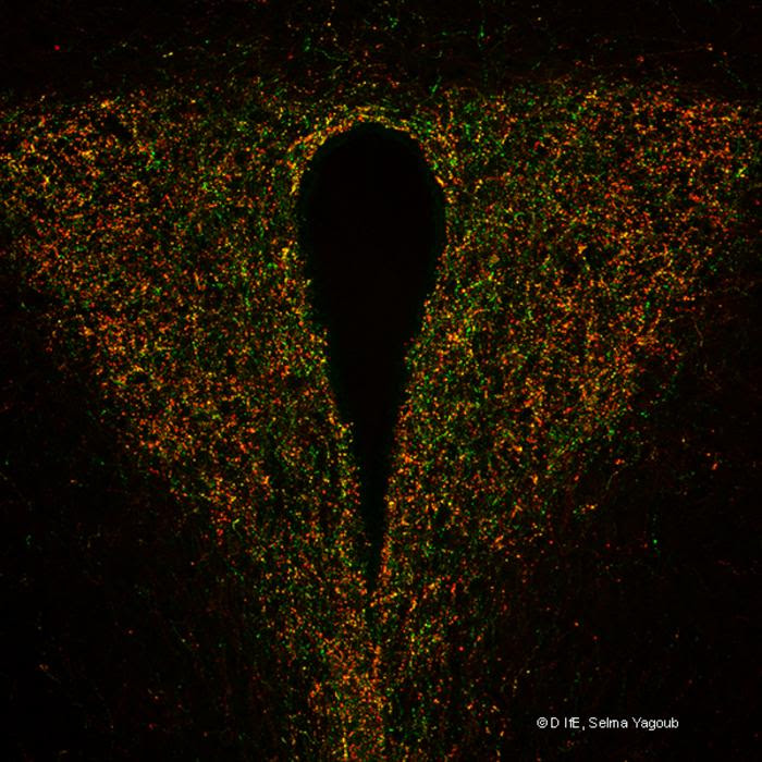 Fat Alone Does Not Cause Changes in the Hypothalamus