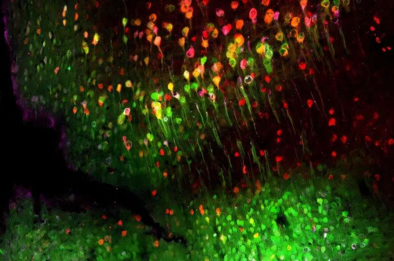 Researchers at TAU discovered a potential new target for developing effective treatments for Parkinson's disease