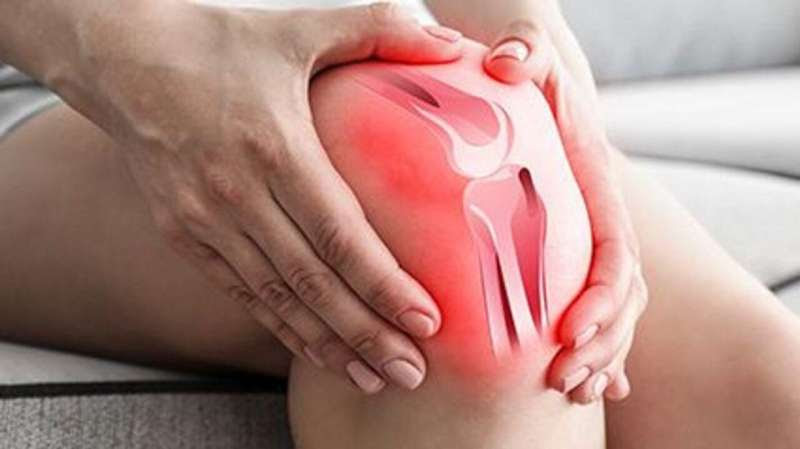 ACR: colchicine no benefit for painful knee osteoarthritis