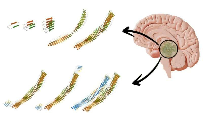 Alzheimer's research: Superspreader fibrils caught in the act