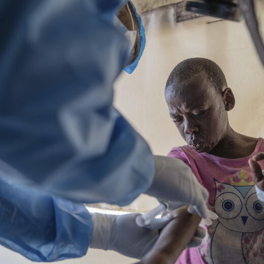 A health worker attends to a mpox patient, at a treatment centre in Munigi, eastern Congo, Monday, Aug. 19, 2024. Congo will receive the first vaccine doses to address its mpox outbreak next week from the United States, the country's health minister said Monday, days after the World Health Organization declared mpox outbreaks in Africa a global emergency. (AP Photo/Moses Sawasawa)