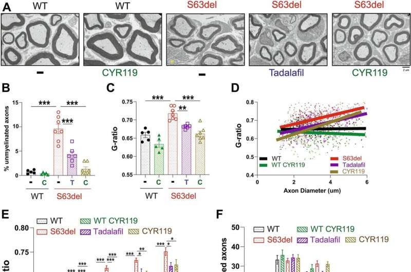 New research offers hope for treating inherited peripheral neuropathies