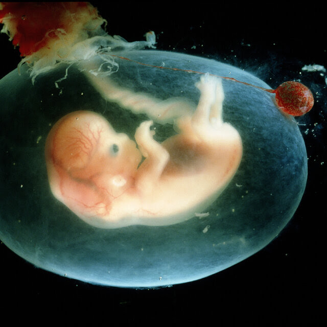 A photo from inside the womb of a human embryo at seven or eight weeks, enveloped in its amniotic sac and attached to the mother via umbilical cord.