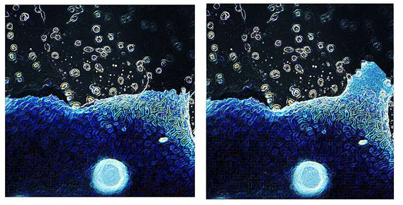 Novel 'scaffolding' biomaterial improves bladder regeneration and function