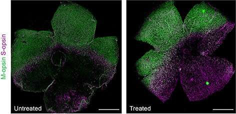 New UCI-led study lays foundation for establishing base editing as a one-time, durable treatment for inherited retinal degenerat