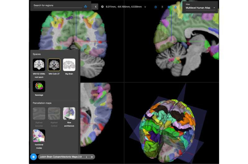 Multilevel brain atlases provide tools for better diagnosis