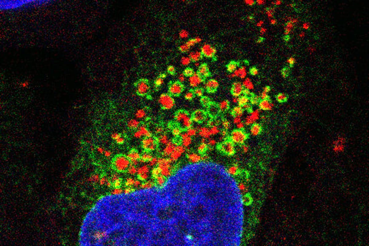 In this fluorescence microscopy image, the endoplasmic reticulum network seen in green wraps around damaged lysosomes seen in red