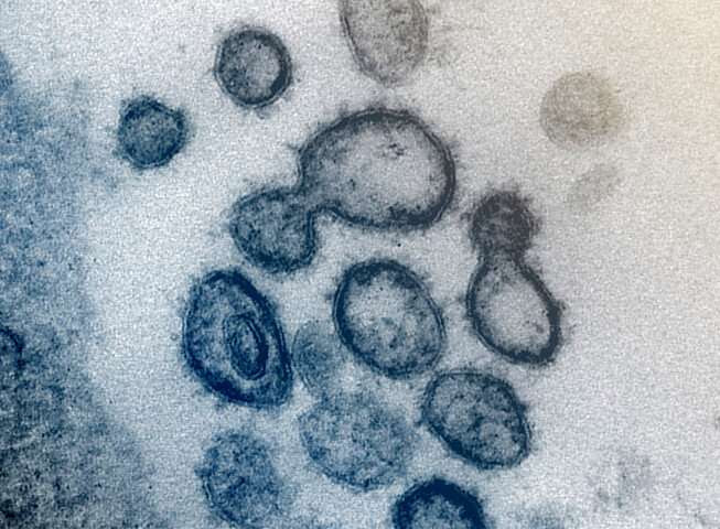 coronavirus , COVID-19