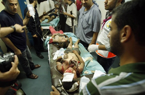 Niños heridos en un ataque aéreo israelí contra una vivienda en la ciudad de Gaza