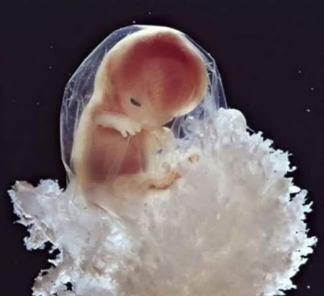 Những bức ảnh đáng kinh ngạc về sự phát triển của thai nhi trong bụng mẹ - 12