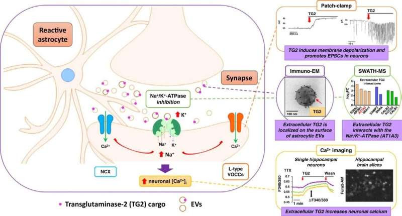 Microscopic ‘nano-shuttles’ may help drive degeneration of brain cells, research suggests