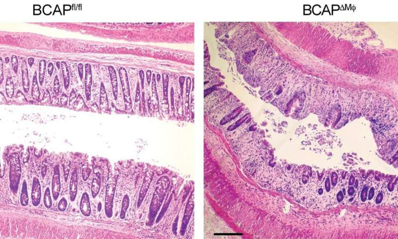 Study pinpoints target for managing inflammation, promoting tissue repair