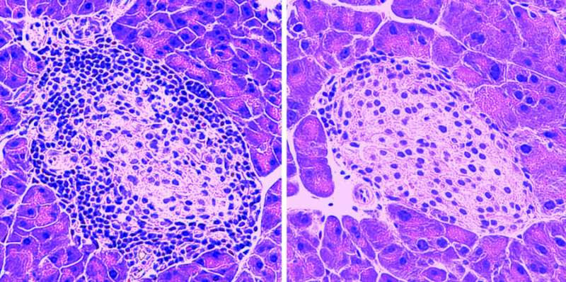 Small protein protects pancreatic cells in model of type 1 diabetes