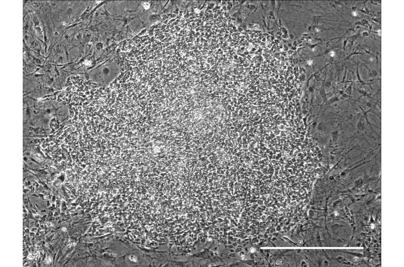 Researchers identify sustainable source of immunodeficiency virus-resistant immune cells