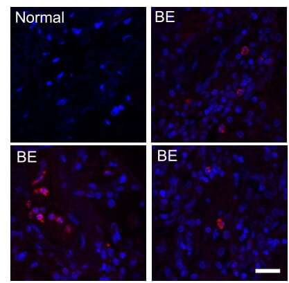 International study led by Singapore scientists discovers bacteria previously thought harmless can worsen existing lung disease