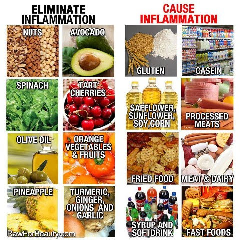 Anti-Inflammatory Remedies For Pain: Used Topically And Orally (Video) 