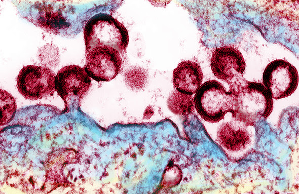 HIV virions budding from infected cell