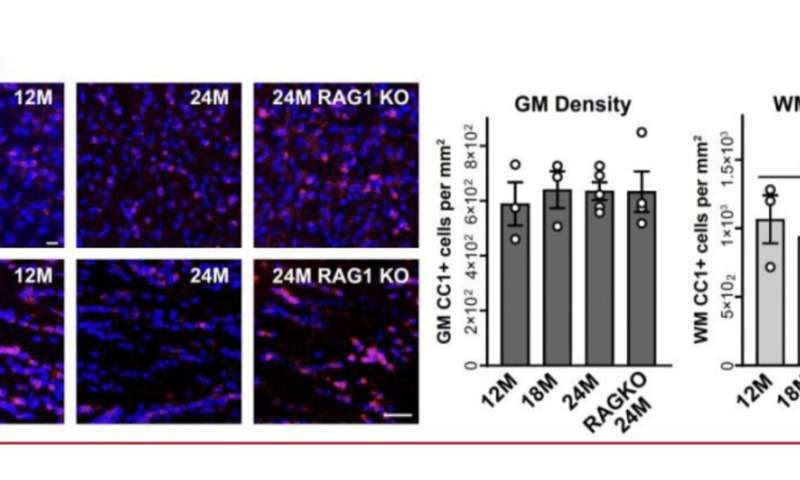 Study shows that adaptive immune responses can cause cellular loss in the aging brain