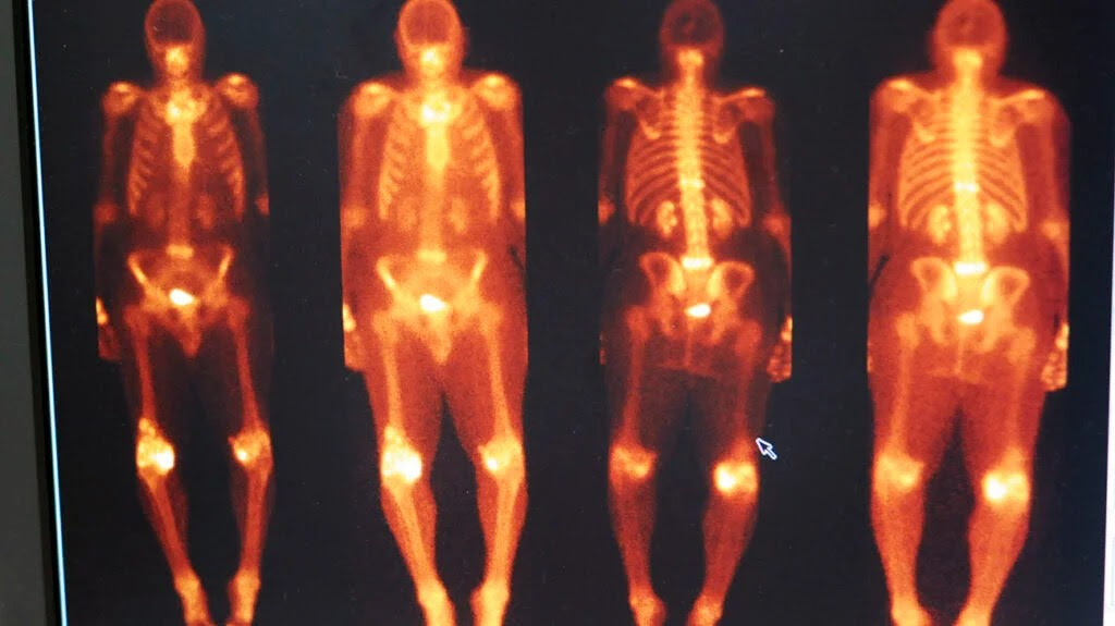 A X-ray shows four human skeletons