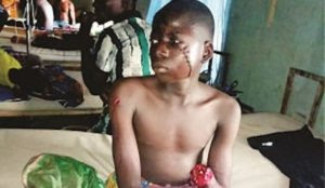Nigeria: Muslims invade village, amputate hand of 14-year-old boy, murder his parents