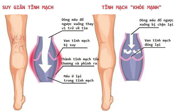 Đông y: Làm việc này với đôi bàn chân, sống trăm tuổi không hề là ảo vọng - Ảnh 8. Đông y: Làm việc này với đôi bàn chân, sống trăm tuổi không hề là ảo vọng - Ảnh 8.
