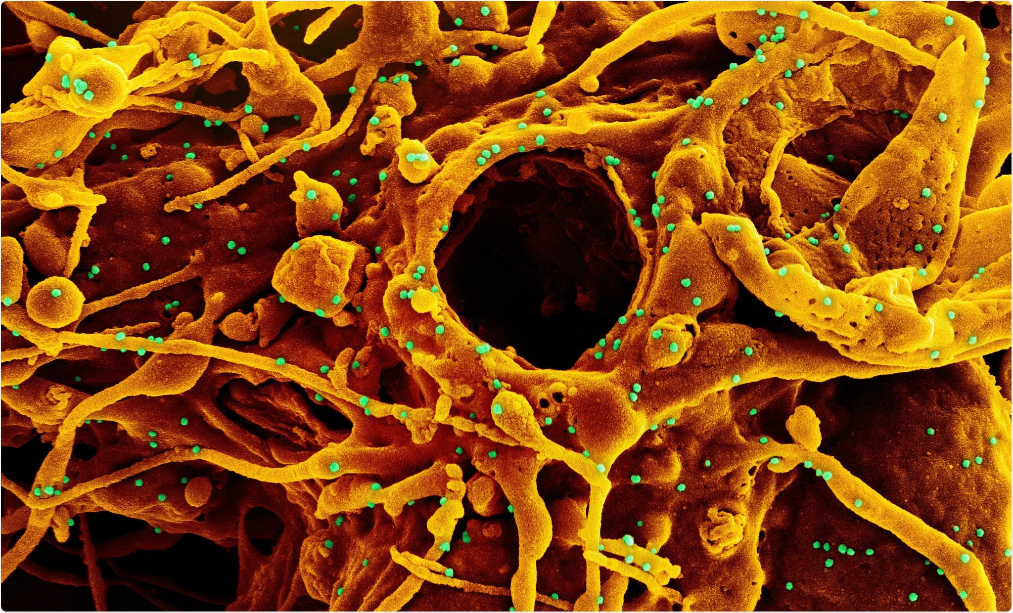 Study: High-Potency Polypeptide-based Interference for Coronavirus Spike Glycoproteins. Image Credit: NIAID