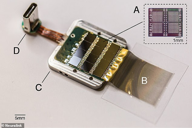 The tech tycoon explained that the device is about one inch in diameter, similar to the face of a smart watch, and is implanted by removing a small chunk of the skull