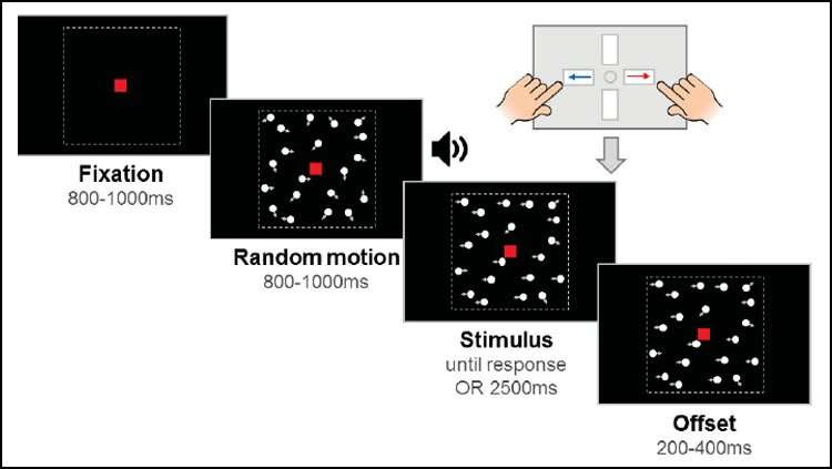 Visual processing is slower in children with dyslexia