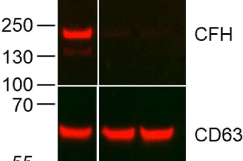 Antibody targets mechanism that enables lung cancer to grow and spread