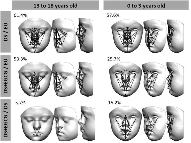 Green tea supplements modulate facial development of children with Down syndrome