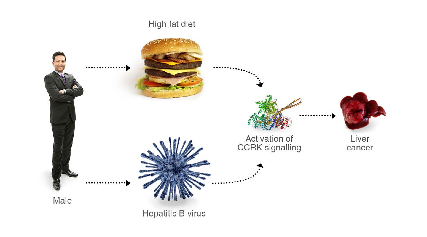 Why are men at a loss? Professor Cheng’s research team unveiled a male sex hormone-deregulated pathway that might contribute to liver cancer induced by either hepatitis virus or obesity