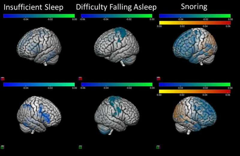 Inadequate sleep is bad for preteens' brains