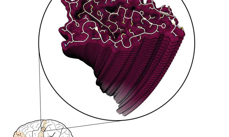 First detailed images of molecule associated with ALS could open door to therapies