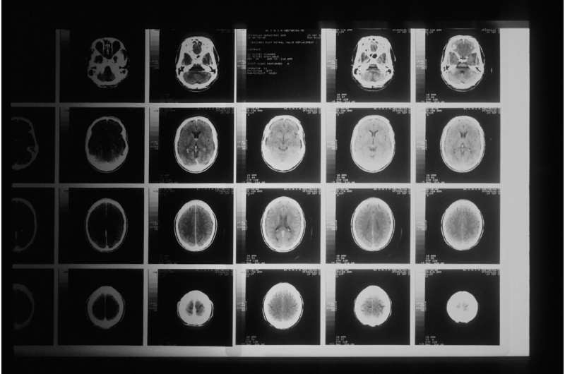 brain imaging